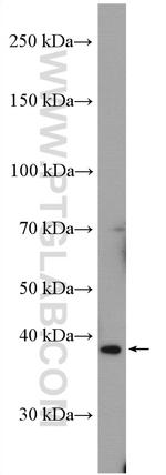 TPM2 Antibody in Western Blot (WB)