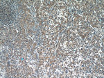 TPM3 Antibody in Immunohistochemistry (Paraffin) (IHC (P))