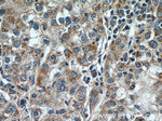 TPM3 Antibody in Immunohistochemistry (Paraffin) (IHC (P))