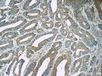 TPM3 Antibody in Immunohistochemistry (Paraffin) (IHC (P))