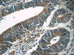 TPM3 Antibody in Immunohistochemistry (Paraffin) (IHC (P))