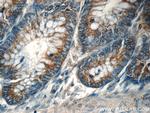 TPM3 Antibody in Immunohistochemistry (Paraffin) (IHC (P))