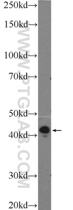 TPM3 Antibody in Western Blot (WB)