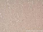 AHSA2 Antibody in Immunohistochemistry (Paraffin) (IHC (P))