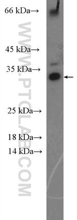 AHSA2 Antibody in Western Blot (WB)