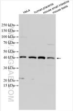 B4GALT1 Antibody in Western Blot (WB)