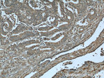 NOV Antibody in Immunohistochemistry (Paraffin) (IHC (P))