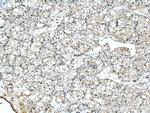 NOV Antibody in Immunohistochemistry (Paraffin) (IHC (P))