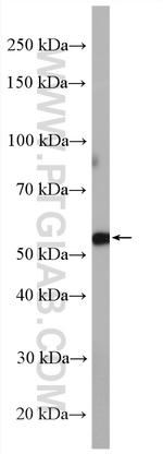 Cyp2c7 Antibody in Western Blot (WB)