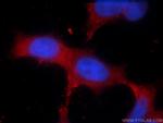 TRPM6 Antibody in Immunocytochemistry (ICC/IF)