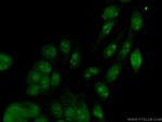 UBE2E1 Antibody in Immunocytochemistry (ICC/IF)