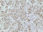 UBE2E1 Antibody in Immunohistochemistry (Paraffin) (IHC (P))