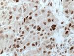 UBE2E1 Antibody in Immunohistochemistry (Paraffin) (IHC (P))
