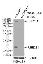 UBE2E1 Antibody in Western Blot (WB)