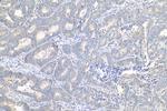 Phospholipase C epsilon 1 Antibody in Immunohistochemistry (Paraffin) (IHC (P))