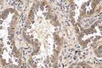 Phospholipase C epsilon 1 Antibody in Immunohistochemistry (Paraffin) (IHC (P))
