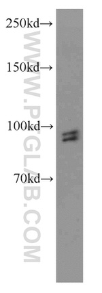NPAS3 Antibody in Western Blot (WB)