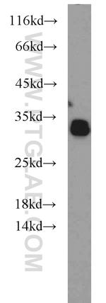 NPAS3 Antibody in Western Blot (WB)