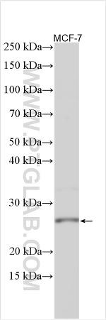 GSTM2 Antibody in Western Blot (WB)