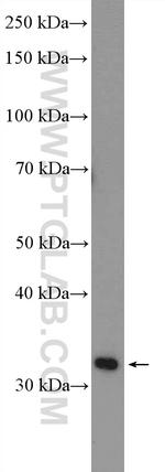 LRRC38 Antibody in Western Blot (WB)