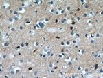 NKX1-2 Antibody in Immunohistochemistry (Paraffin) (IHC (P))