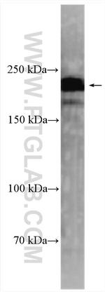 Rootletin Antibody in Western Blot (WB)