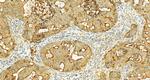 MUC13 Antibody in Immunohistochemistry (Paraffin) (IHC (P))