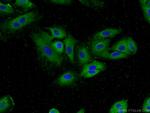 MUC8 Antibody in Immunocytochemistry (ICC/IF)