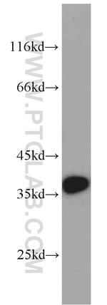 MUC8 Antibody in Western Blot (WB)