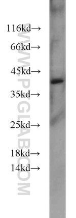 MUC8 Antibody in Western Blot (WB)
