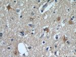 VGLUT1 Antibody in Immunohistochemistry (Paraffin) (IHC (P))