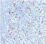 Perforin-1 (Pore Forming Protein) (Apoptosis Marker) Monoclonal Antibody (PRF1/2470)