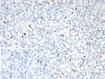 Perforin-1 (Pore Forming Protein) (Apoptosis Marker) Recombinant Mouse Monoclonal Antibody (rPRF1/8058)
