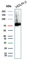 Perforin-1 (Pore Forming Protein) (Apoptosis Marker) Antibody in Western Blot (WB)