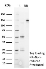 Perforin-1 (Pore Forming Protein) (Apoptosis Marker) Antibody in SDS-PAGE (SDS-PAGE)