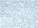 Perforin-1 (Pore Forming Protein) (Apoptosis Marker) Recombinant Rabbit Monoclonal Antibody (PRF1/7077R)