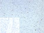 Perforin-1 (Pore Forming Protein) (Apoptosis Marker) Recombinant Rabbit Monoclonal Antibody (PRF1/8662R)