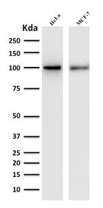 ENAH/MENA (Actin Regulator) Monoclonal Antibody (ENAH, 1988)