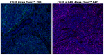 CD20 Antibody in Immunohistochemistry (Paraffin) (IHC (P))
