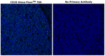 CD20 Antibody in Immunohistochemistry (Paraffin) (IHC (P))
