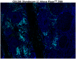 CD138 Antibody in Immunohistochemistry (Paraffin) (IHC (P))