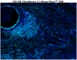 CD138 Antibody in Immunohistochemistry (Paraffin) (IHC (P))