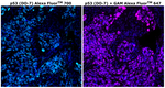 p53 Antibody in Immunohistochemistry (Paraffin) (IHC (P))