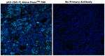 p53 Antibody in Immunohistochemistry (Paraffin) (IHC (P))