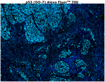 p53 Antibody in Immunohistochemistry (Paraffin) (IHC (P))