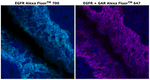 EGFR Antibody in Immunohistochemistry (Paraffin) (IHC (P))