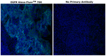 EGFR Antibody in Immunohistochemistry (Paraffin) (IHC (P))