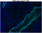 EGFR Antibody in Immunohistochemistry (Paraffin) (IHC (P))