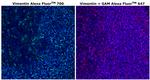 Vimentin Antibody in Immunohistochemistry (Paraffin) (IHC (P))