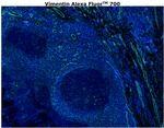 Vimentin Antibody in Immunohistochemistry (Paraffin) (IHC (P))